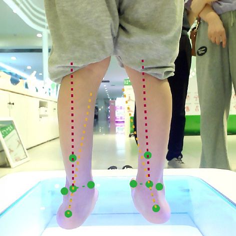 儿童步态训练插图4