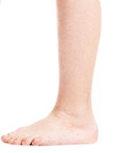 步态异常对儿童的影响插图