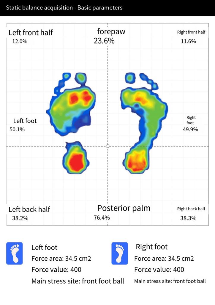 F2 足底压力检测仪插图8