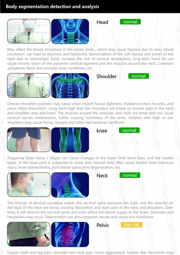 X5力线检测定制系统插图10
