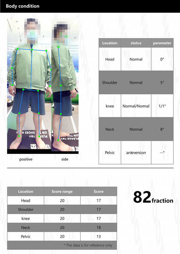 X5力线检测定制系统插图11