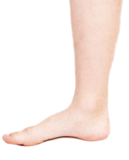 步态异常对儿童的影响插图1