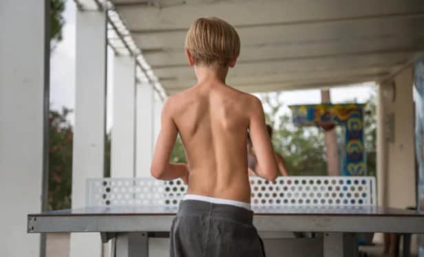 常见的儿童步态问题插图14