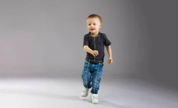 常见的儿童步态问题插图15