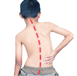 常见的儿童步态问题插图11