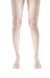 常见的儿童步态问题插图8