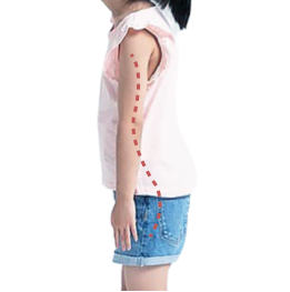 常见的儿童步态问题插图9