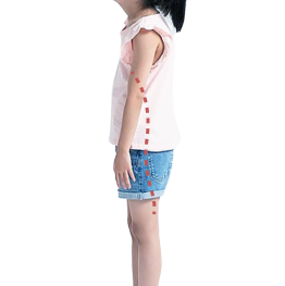 常见的儿童步态问题插图10