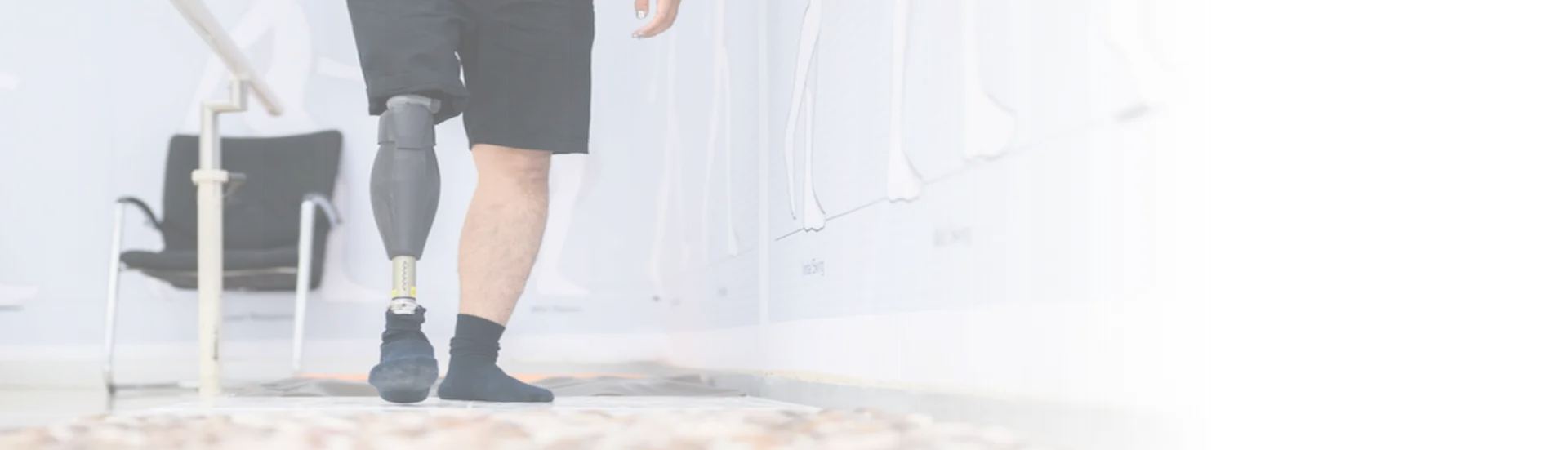 Gait Analysis in Prosthetic Rehabilitation