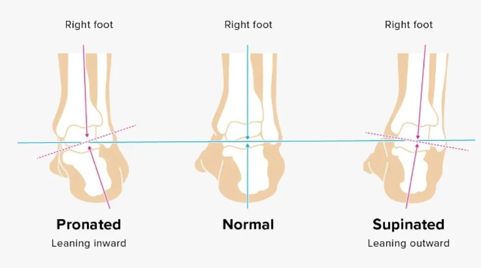 Pronation
