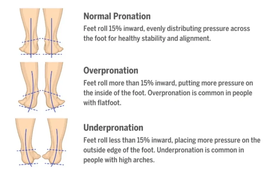 Types of pronation