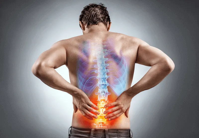 Low Back Pain